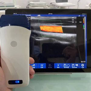 128 Elements 7.5/10MHz Linear Probe Handheld B/W Ultrasound　